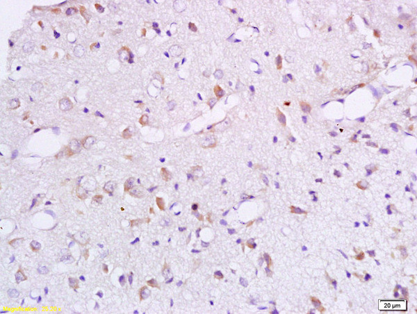 BCAT1 Antibody in Immunohistochemistry (Paraffin) (IHC (P))