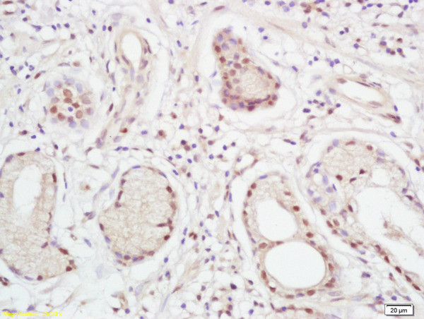 XPC Antibody in Immunohistochemistry (Paraffin) (IHC (P))