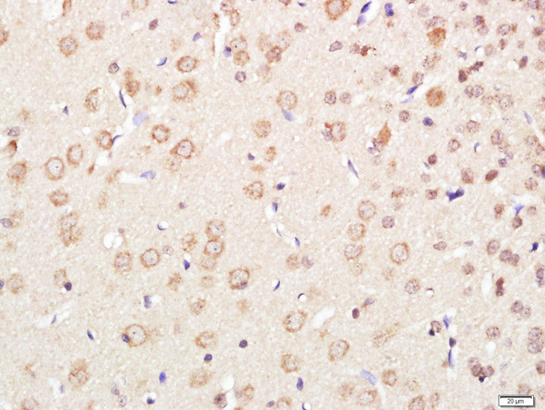 XPC Antibody in Immunohistochemistry (Paraffin) (IHC (P))