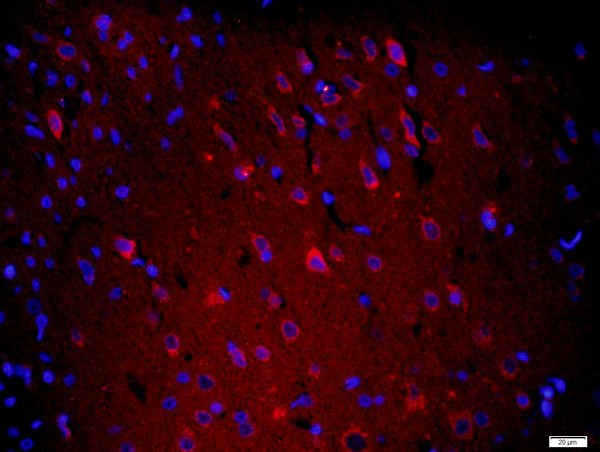 XPC Antibody in Immunohistochemistry (Paraffin) (IHC (P))