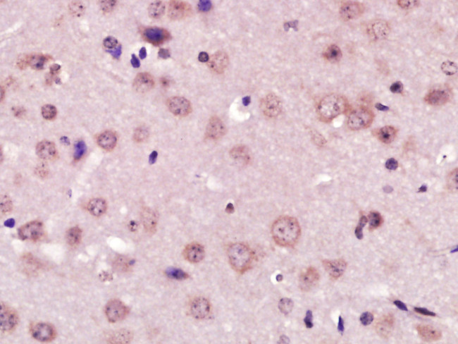 XPC Antibody in Immunohistochemistry (Paraffin) (IHC (P))