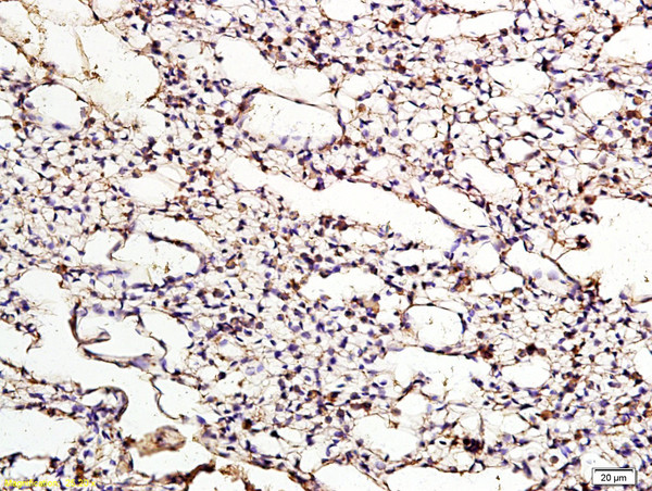 ApoER2 Antibody in Immunohistochemistry (Paraffin) (IHC (P))