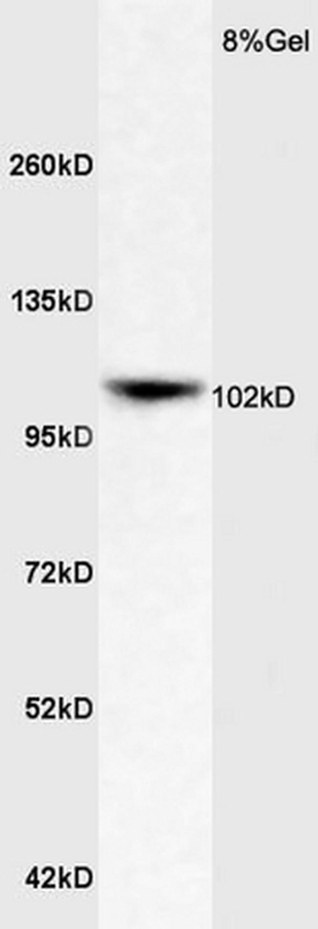 ApoER2 Antibody in Western Blot (WB)