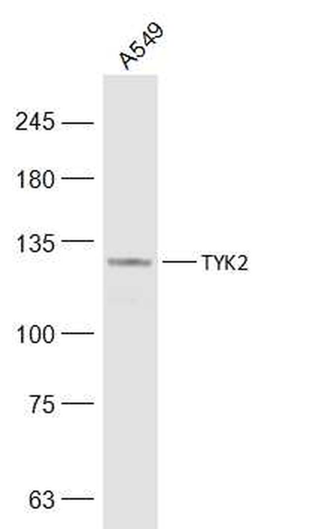 TYK2 Antibody in Western Blot (WB)