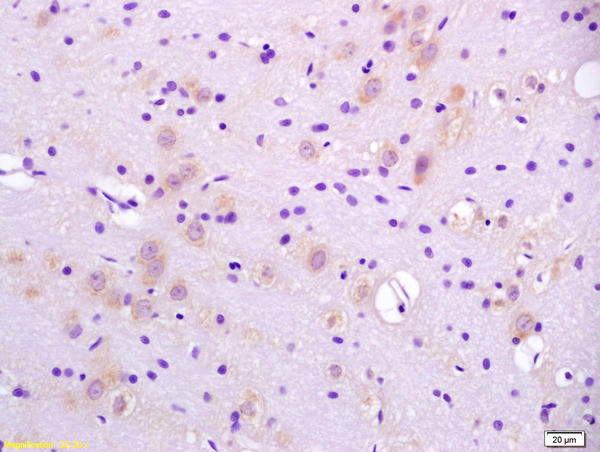 CaI-PLA2 Antibody in Immunohistochemistry (Paraffin) (IHC (P))