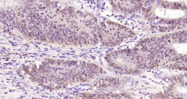 UGDH Antibody in Immunohistochemistry (Paraffin) (IHC (P))