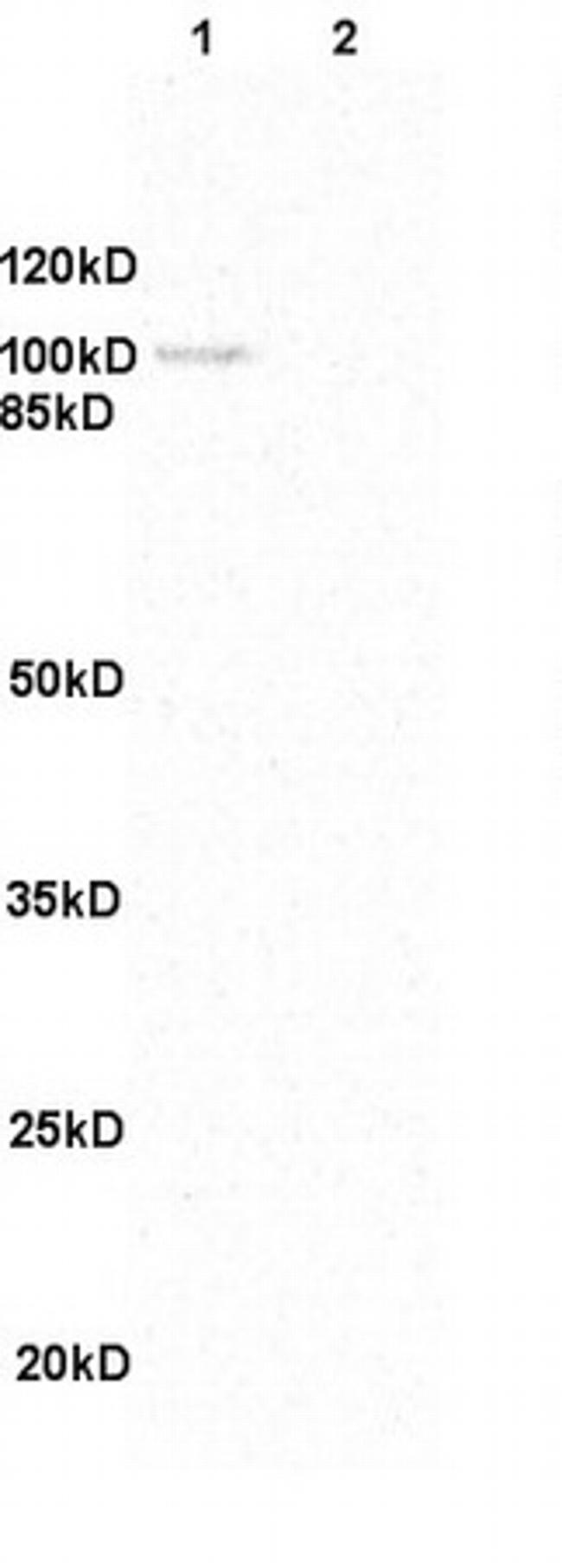 GANAB Antibody in Western Blot (WB)