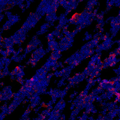 Perilipin A+B Antibody in Immunocytochemistry (ICC/IF)