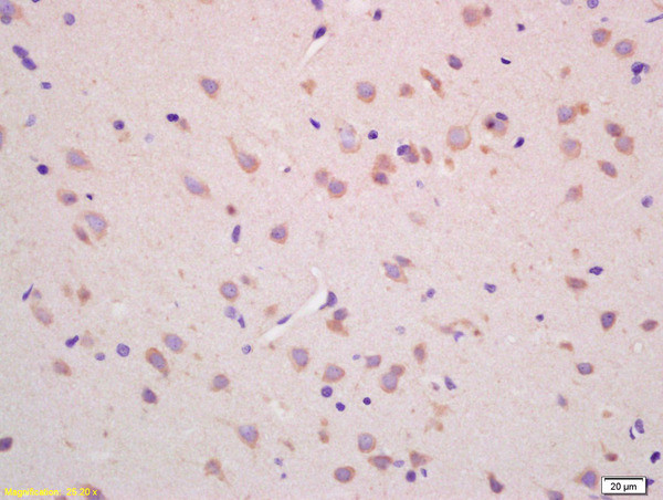 CHAC1 Antibody in Immunohistochemistry (Paraffin) (IHC (P))