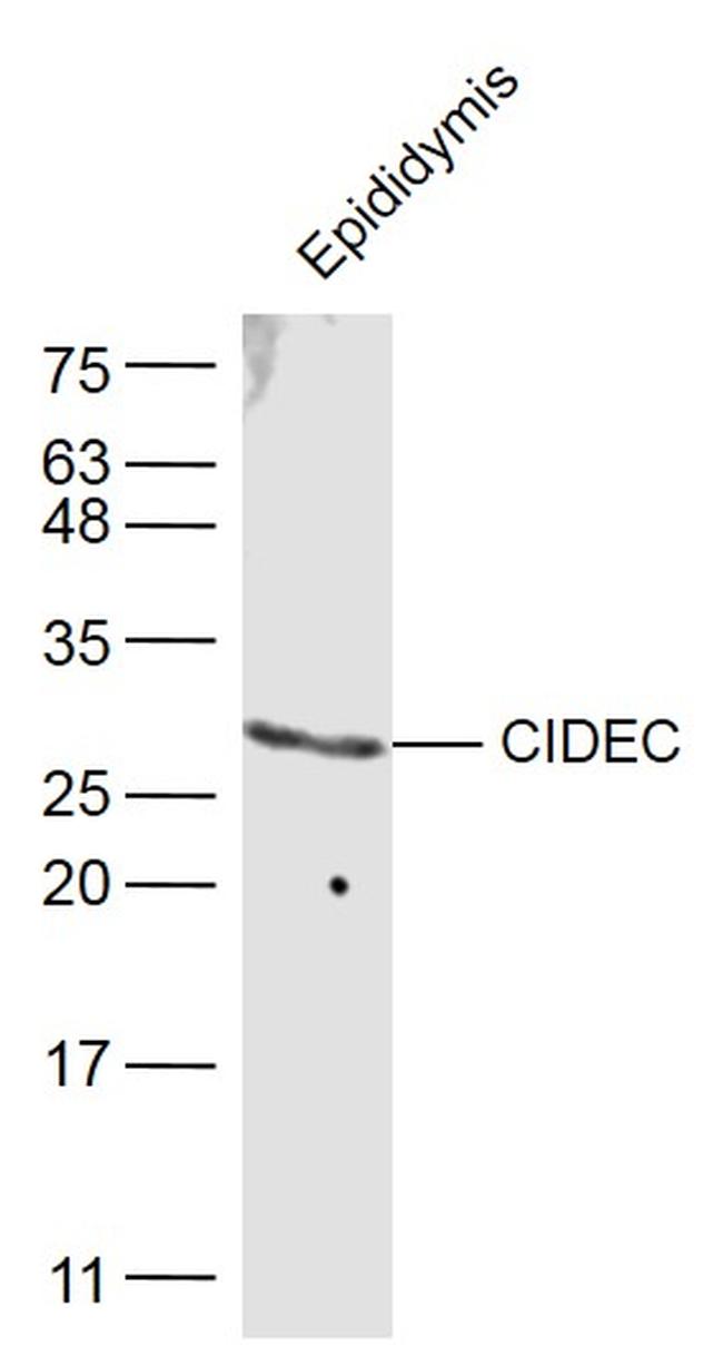 CIDEC Antibody in Western Blot (WB)