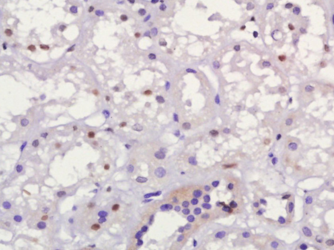 MUM1 Antibody in Immunohistochemistry (Paraffin) (IHC (P))