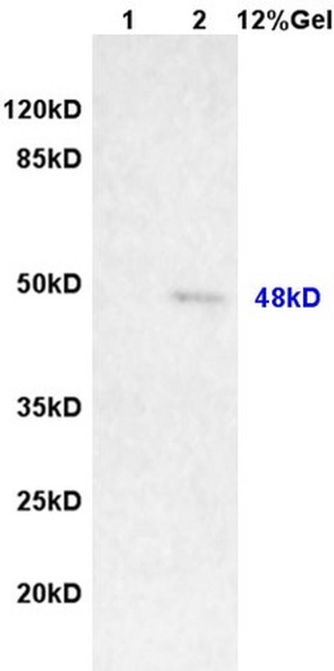 MAGEA11 Antibody in Western Blot (WB)