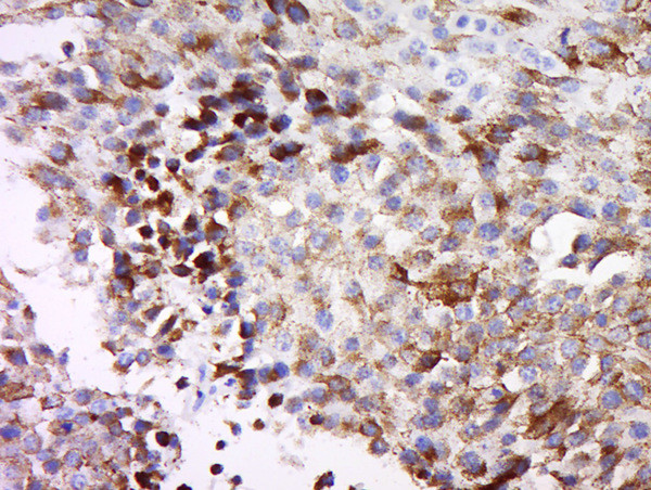 MAGEB3 Antibody in Immunohistochemistry (Paraffin) (IHC (P))