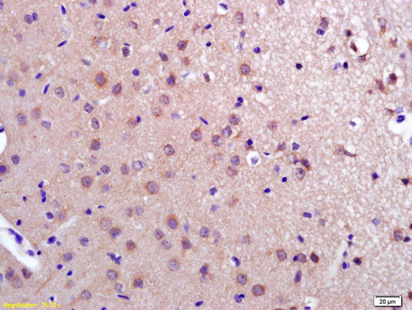 PDCD10 Antibody in Immunohistochemistry (Paraffin) (IHC (P))