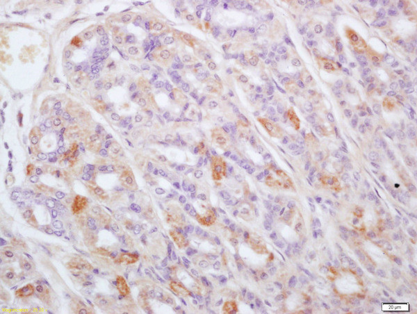 TPST1 Antibody in Immunohistochemistry (Paraffin) (IHC (P))