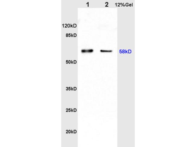 Catalase Antibody in Western Blot (WB)