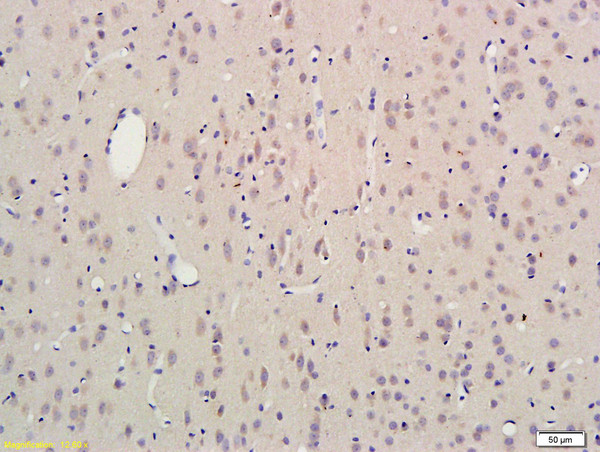 SCN3B Antibody in Immunohistochemistry (Paraffin) (IHC (P))