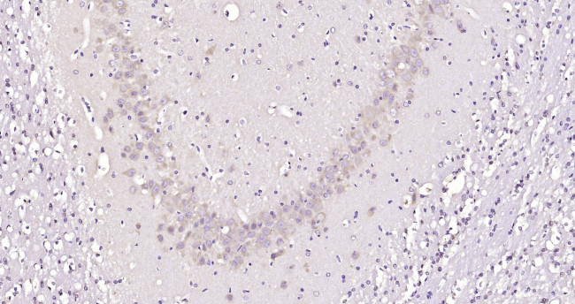 STK40 Antibody in Immunohistochemistry (Paraffin) (IHC (P))