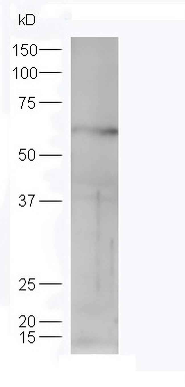 STK40 Antibody in Western Blot (WB)