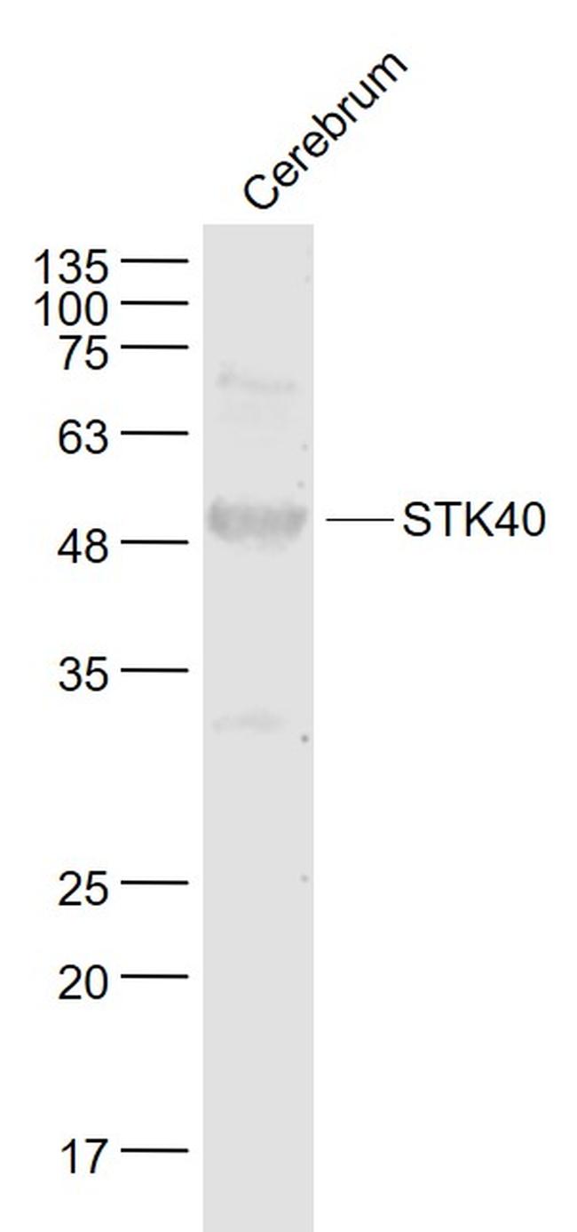 STK40 Antibody in Western Blot (WB)