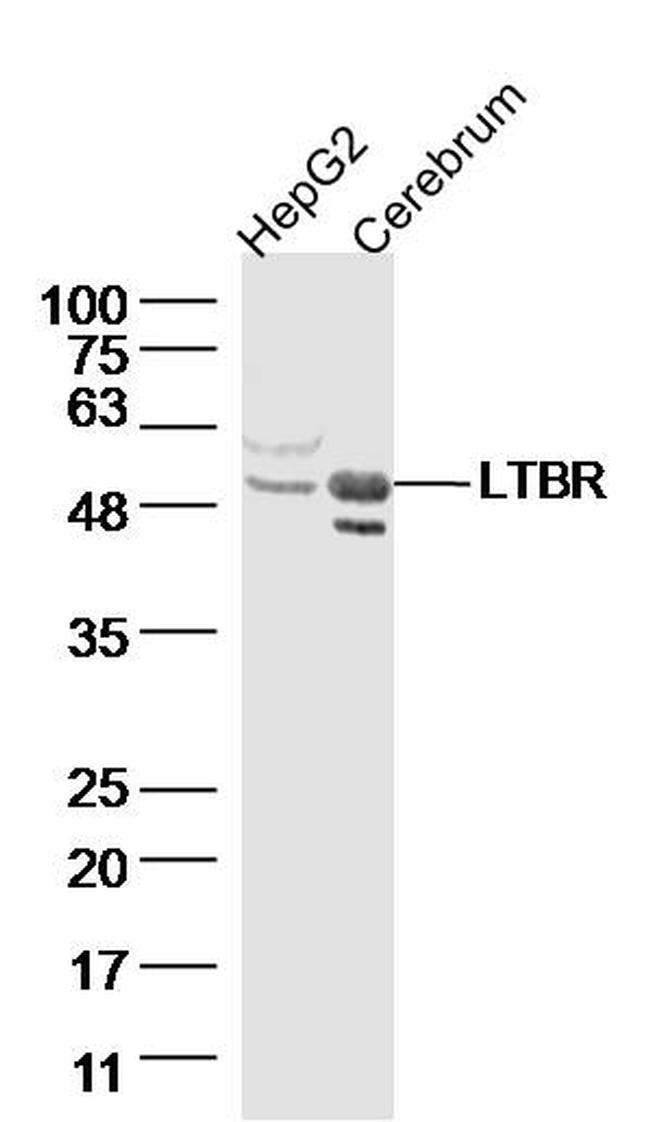 LTBR Antibody in Western Blot (WB)