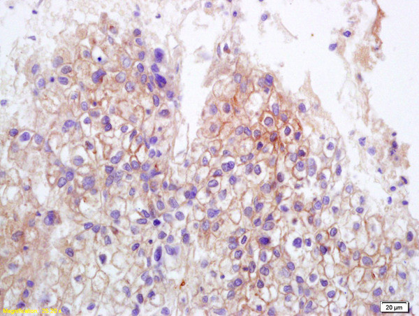 MICA+MICB Antibody in Immunohistochemistry (Paraffin) (IHC (P))