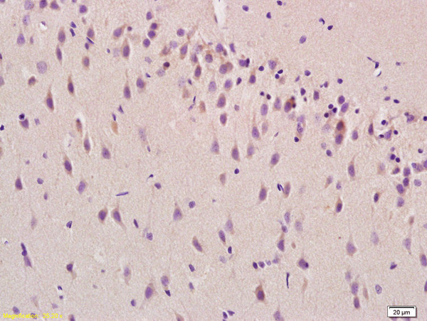 beta synuclein Antibody in Immunohistochemistry (Paraffin) (IHC (P))