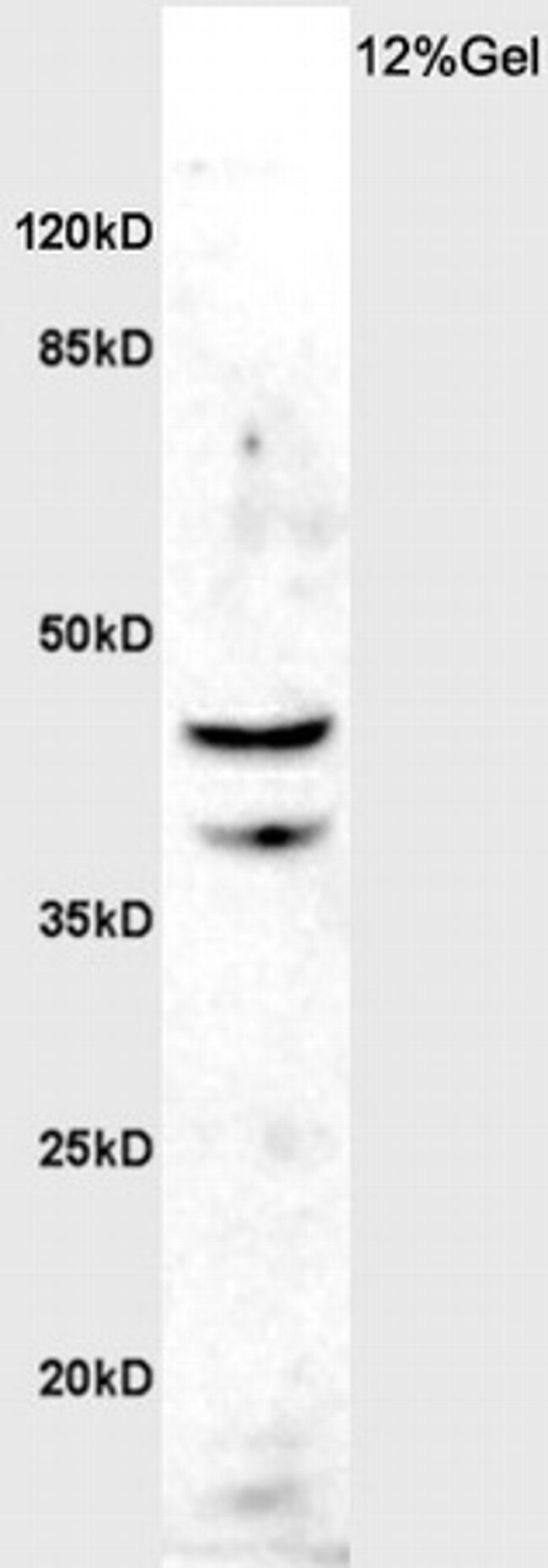 ASMT Antibody in Western Blot (WB)