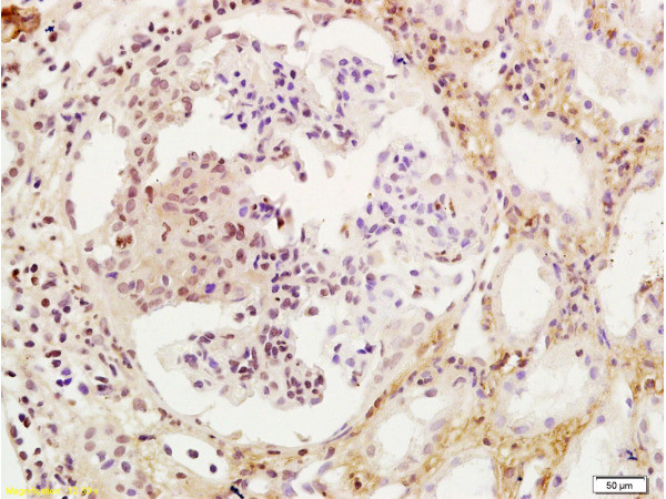 Wilms Tumor Protein Antibody in Immunohistochemistry (Paraffin) (IHC (P))