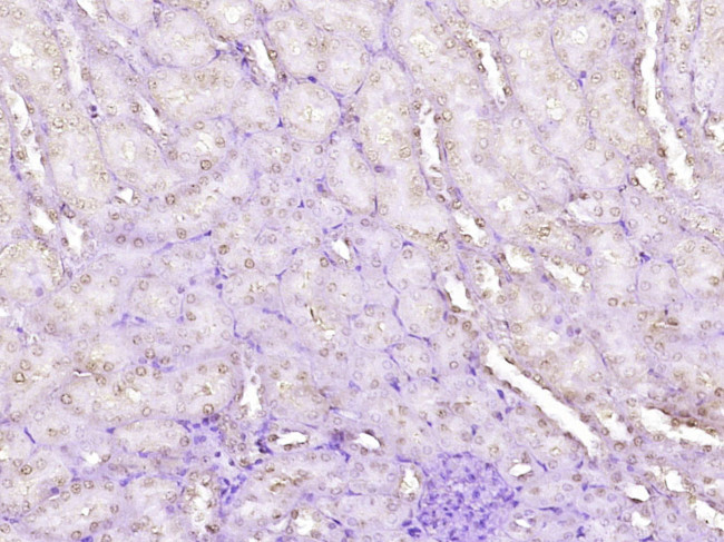 Wilms Tumor Protein Antibody in Immunohistochemistry (Paraffin) (IHC (P))