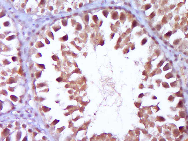Wilms Tumor Protein Antibody in Immunohistochemistry (Paraffin) (IHC (P))