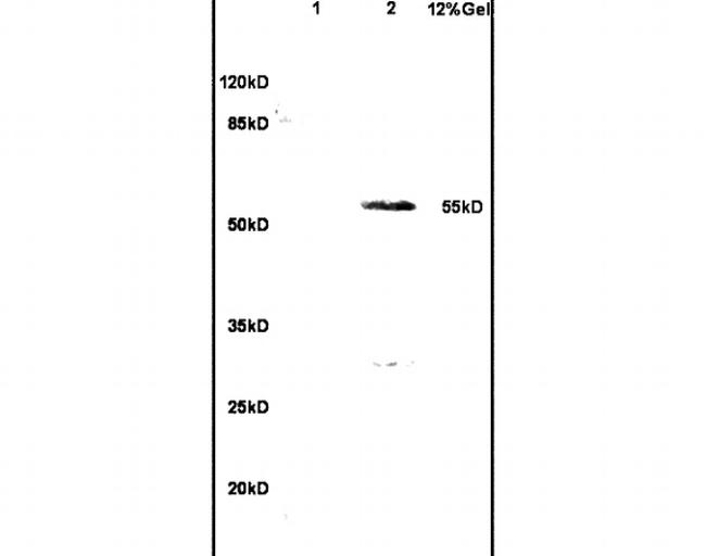 Wilms Tumor Protein Antibody in Western Blot (WB)