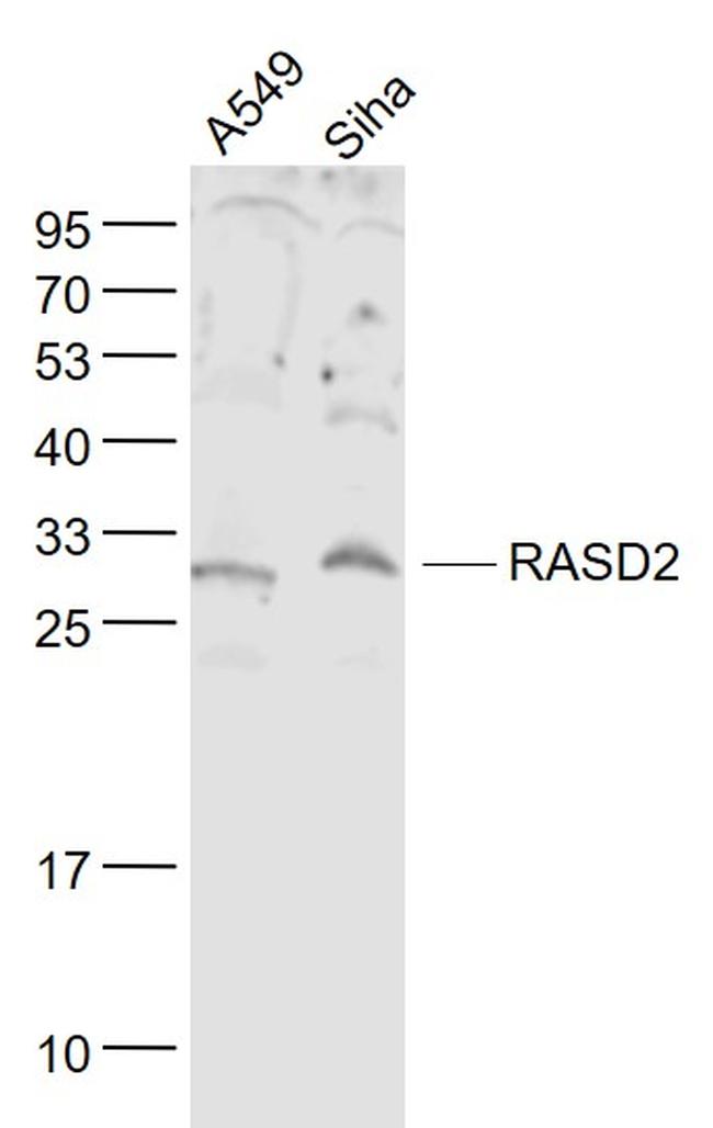 RASD2 Antibody in Western Blot (WB)