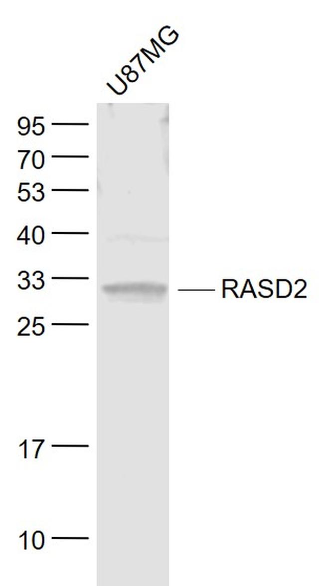 RASD2 Antibody in Western Blot (WB)