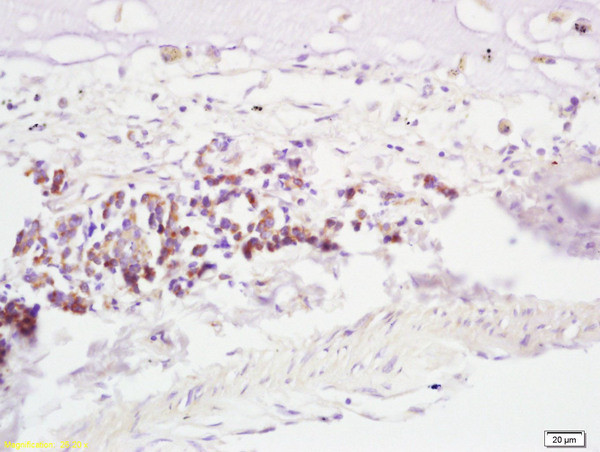 RNF43 Antibody in Immunohistochemistry (Paraffin) (IHC (P))