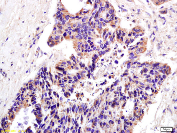 XAGE2 Antibody in Immunohistochemistry (Paraffin) (IHC (P))