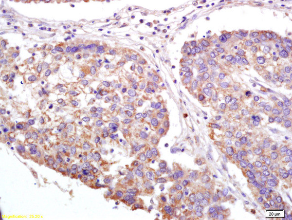 XAGE2 Antibody in Immunohistochemistry (Paraffin) (IHC (P))