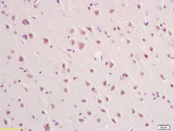 IFNAR2 Antibody in Immunohistochemistry (Paraffin) (IHC (P))