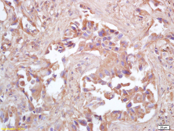 HSP10 Antibody in Immunohistochemistry (Paraffin) (IHC (P))