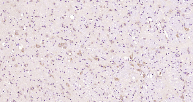 EphB1 Antibody in Immunohistochemistry (Paraffin) (IHC (P))