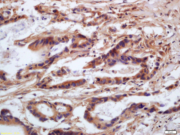 Phospho-MYL9 (Ser20) Antibody in Immunohistochemistry (Paraffin) (IHC (P))