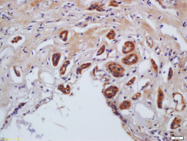 Phospho-MYL9 (Ser20) Antibody in Immunohistochemistry (Paraffin) (IHC (P))