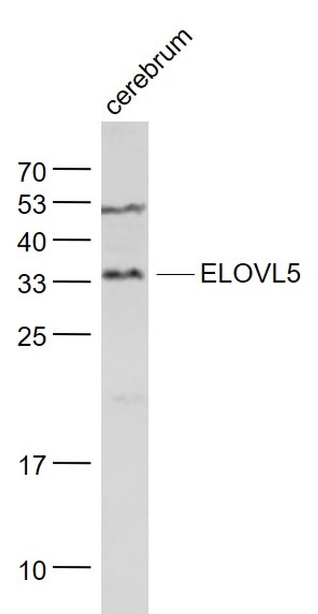 ELOVL5 Antibody in Western Blot (WB)