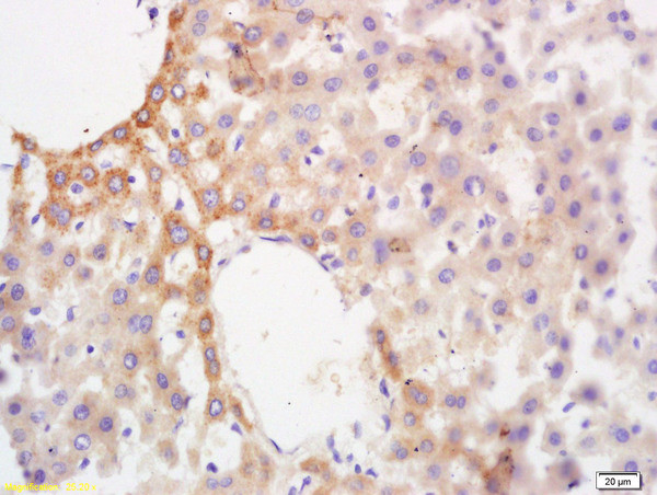 Glucokinase regulatory protein Antibody in Immunohistochemistry (Paraffin) (IHC (P))