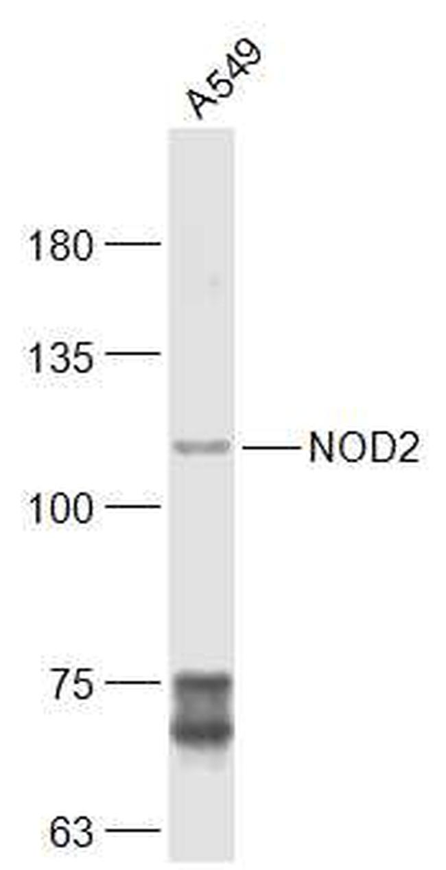 NOD2 Antibody in Western Blot (WB)