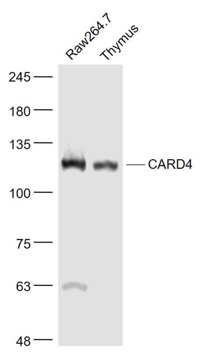 CARD4 Antibody in Western Blot (WB)