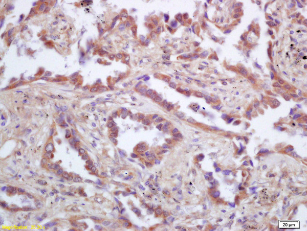 p53AIP1 Antibody in Immunohistochemistry (Paraffin) (IHC (P))