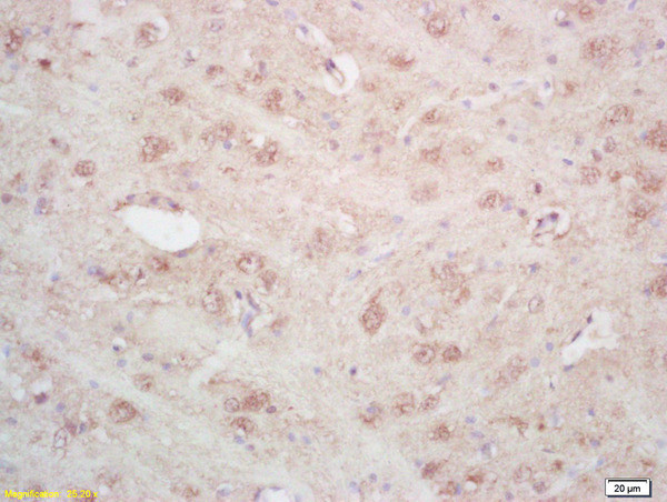 SEPT4 Antibody in Immunohistochemistry (Paraffin) (IHC (P))