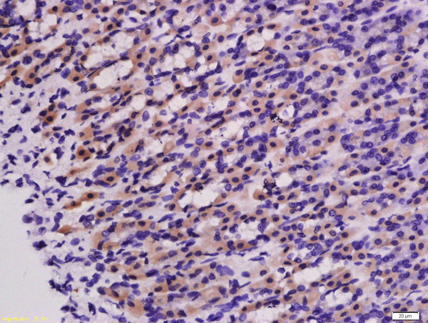 PNPT1 Antibody in Immunohistochemistry (Paraffin) (IHC (P))