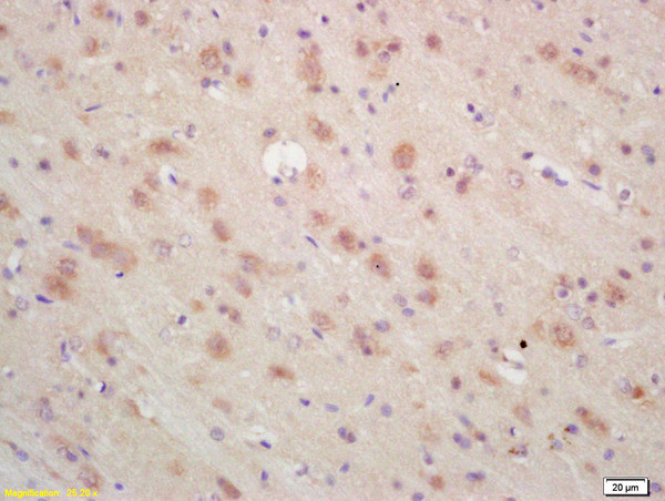 ARP3 Antibody in Immunohistochemistry (Paraffin) (IHC (P))